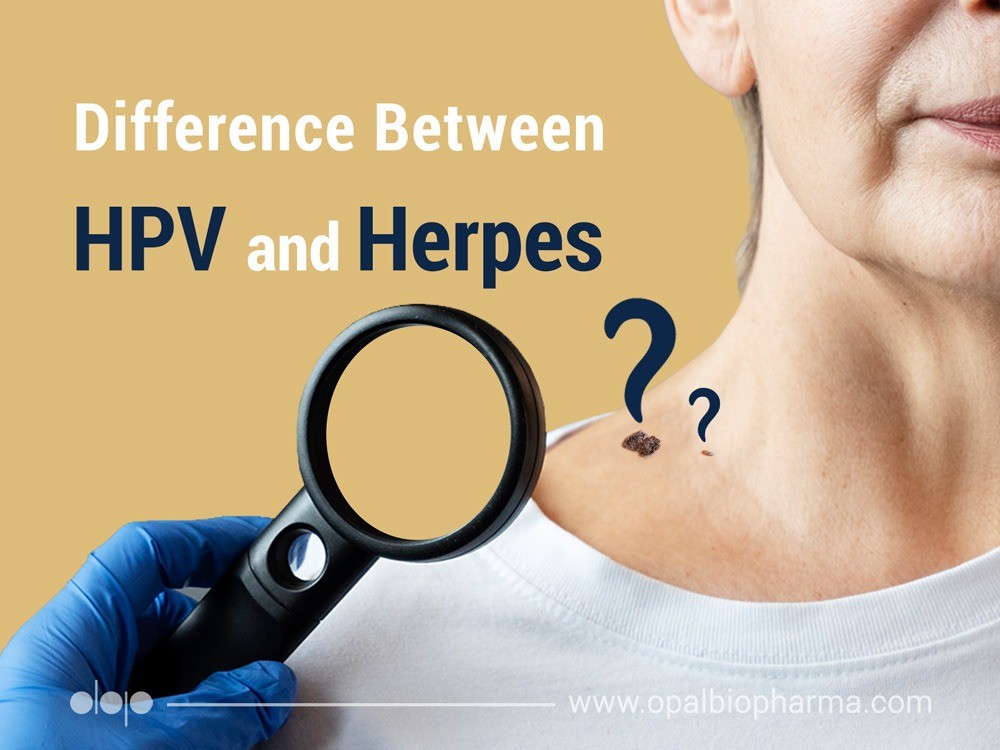 Difference Between HPV And Herpes 