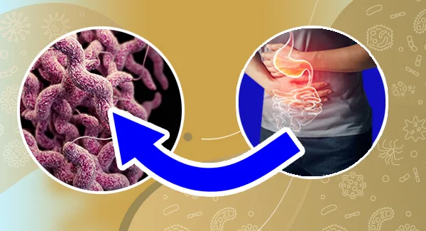 Innovative Approaches in Combating Campylobacter jejuni Infections