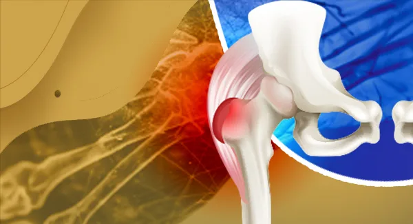 Rheumatoid Arthritis (RA) Treatment: Latest Global Challenges and Breakthrough Innovations