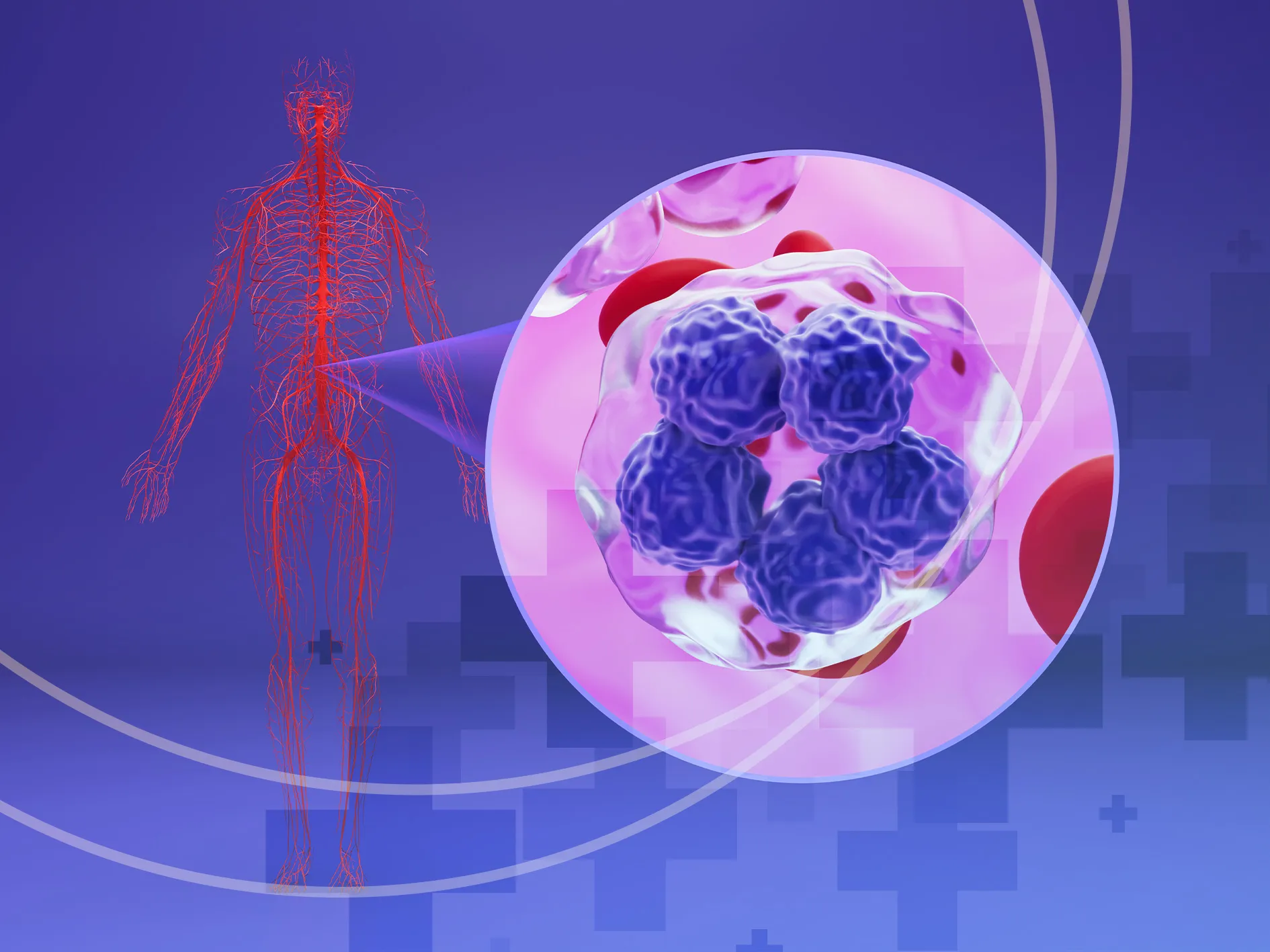 Bridging-Radiation-Before-CAR-T;-A-Targeted-Approach-to-Improving-Outcomes-in-Aggressive-B-Cell-Lymphoma_11zon